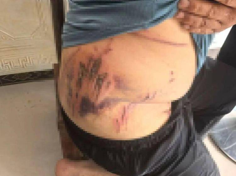 白俄罗斯 vs丹麦_湖北鹤峰县疑再现老虎踪迹白俄罗斯 vs丹麦，村民家猪遭袭，玉米地发现脚印，此前男子自称干农活时被抓伤，当地回应