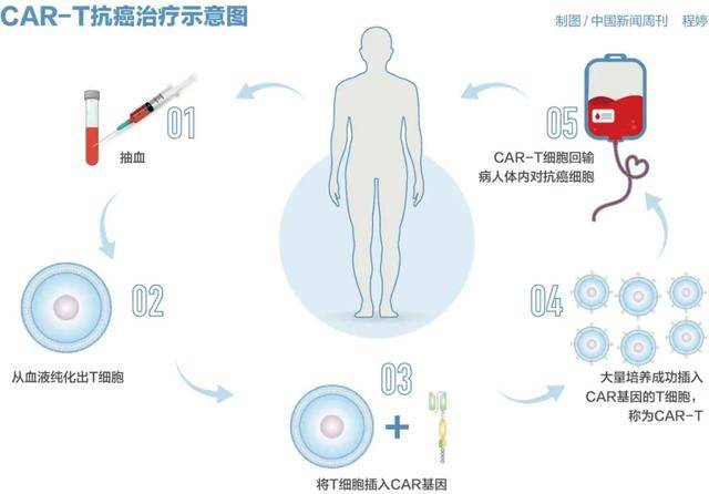 皇冠球网怎么做代理
_百万元的抗癌药皇冠球网怎么做代理
，有望大幅降价？