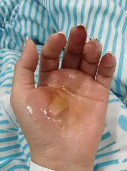 皇冠官网_滚烫的水皇冠官网,从头流到脚!今晚洗澡前紧急提醒!